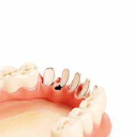 Modèle de restauration d'implant dentaire de qualité médicale Ecolab, pont Malo, couronne en zircone pour les cours de formation en éducation dentaire, ISO 9001