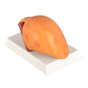 Silikon tıbbi bilim karaciğer modeli Normal alkollü yağlı alkolsüz yağlı karaciğer - Product Image 3