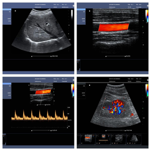 Ecografo Doppler a Colori Portatile di Grado Ospedaliero per Esami Ginecologici, Ostetrici e Interventi su Piccoli Organi - Product Image 5