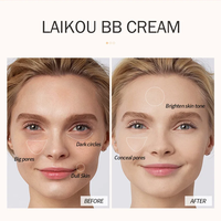 Crème éclaircissante blanchissante à la niacinamide, au rétinol et à l'acide hyaluronique, pour le visage et le corps, tous types de peau, corrige les taches brunes, pour femmes