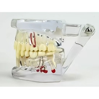 Modèle anatomique dentaire standard de pont amovible pour la restauration des dents, Typodont, Modèle de maladie implantaire, Matériau PVC, Vert, Science Médicale