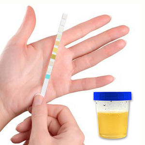 VANSFUL 10 Parameter Urinanalyse-Teststreifen Reagenz streifen für den pH-Wert von Urinanalyse-Keton nitrit - Product Image 5