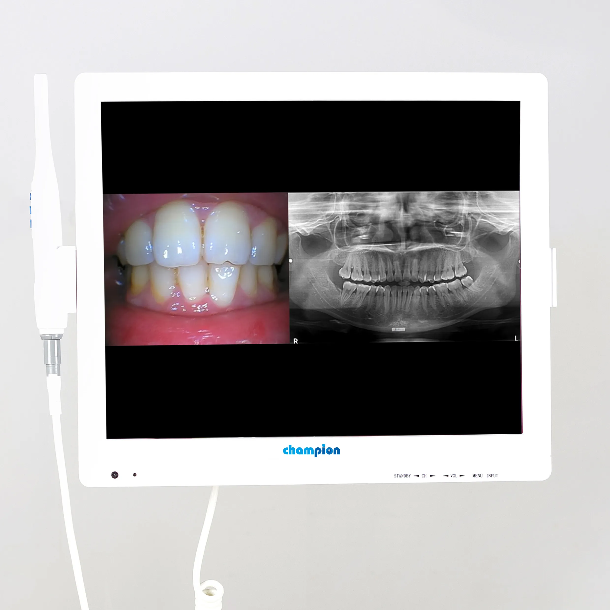 口腔治療機器内視鏡医療用内視鏡カメラ歯科用カメラスクリーン付き