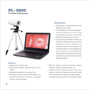 Videocolposcopio Vaginal Médico, Videocolposcopio Digital, Colposcopio Portátil, Colposcopio Ginecológico para Examen - Product Image 6
