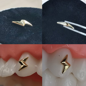 ZZSU - Decoración Dental de Lujo Popular, Gemas Dentales Estilo Hip Hop, Joyería Dental <span class=keywords><strong>para</strong></span> Uso Doméstico, Incluye Muestra Gratis de Joyería Dental - Product Image 3