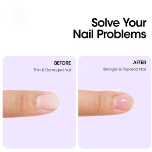Gel UV Protettivo per <span class=keywords><strong>Unghie</strong></span> con Logo Personalizzato OEM ODM, Base Coat Ecologica Senza HEMA e Di-HEMA - Product Image 3