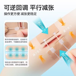 แถบยางยืดโคโฟเอ 19.5 ซม. X 4 ซม. สำหรับเด็ก วัสดุเย็บแผลแบบกาวทางการแพทย์สำหรับการจัดการรอยแผลเป็น - Product Image 2