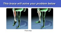 Drop foot AFO Support de Traction attelle de nuit attelle de traction orthèse shell afo Drop foot attelle de cheville