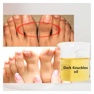 Huile Éclaircissante pour les Taches Sombres des Articulations, Crème Blanchissante la Plus Efficace, Crème Corporelle Forte pour Éliminer les Taches Noires, Ingrédients Pré-Mélangés - Product Image 1