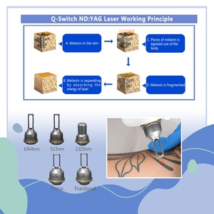 KES Q-switched nd YAG láser eliminación de cejas <span class=keywords><strong>Derma</strong></span> pico láser eliminación de tatuajes láser de picosegundos eliminación de tatuajes máquina de belleza - Product Image 4