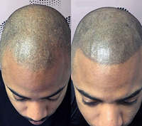 Maquillage permanent lèvres roses micropigmentation permanente pour machine de micropigmentation du cuir chevelu