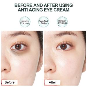 Crème contour des yeux Éclaircissant Raffermissant réparation Rides Yeux bouffants <span class=keywords><strong>Cernes</strong></span> - Product Image 5