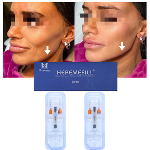 Prix de gros 3ml 5ml Produit de beauté <span class=keywords><strong>Acide</strong></span> <span class=keywords><strong>hyaluronique</strong></span> médical pour <span class=keywords><strong>injection</strong></span> dermique, pour l'allongement du <span class=keywords><strong>menton</strong></span> et le remodelage de la mâchoire - Product Image 2