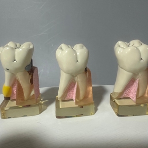 Nha khoa Răng mô hình PVC manikin cho giảng dạy hàm răng giả phân rã & sâu răng quá trình trong y tế khoa học - Product Image 2