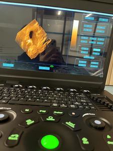 Dierenartsen Ecografie Apparatuur Hot Sales Kleuren Doppler Echografie Systeem Diagnostische Echografie voor Ziekenhuis Kliniek - Product Image 3