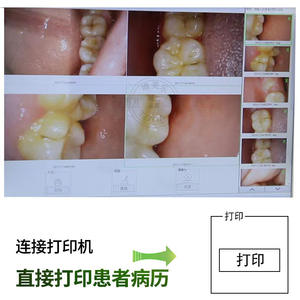 22-Inch All-In-One Computerized <b>Dental</b> <b>Microscope</b> Touch Screen Version for Root Canal Endoscopy for Clinic Examinations - Product Image 4