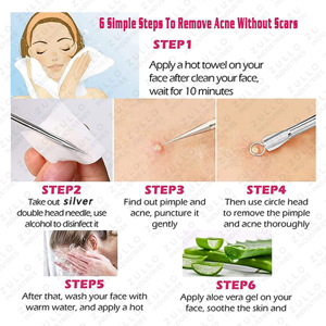 ชุดเครื่องมือสกัดสิว 5 ชิ้น ระดับมืออาชีพ ทำจากสแตนเลส สำหรับกำจัดสิวเสี้ยน ดูแลผิวหน้า - Product Image 6
