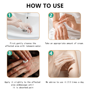 Ungüento antibacteriano profesional a base de hierbas para la piel, gel antiprurito e hidratante de acción rápida para todo tipo de cuidado de la piel - Product Image 5