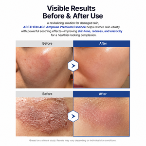 AESTHEIN 4GF Esencia Reafirmante Premium 40ml K-Beauty EGF IGF FGF TGF Antienvejecimiento Cuidado Antiarrugas Regeneración de la Piel - Product Image 3