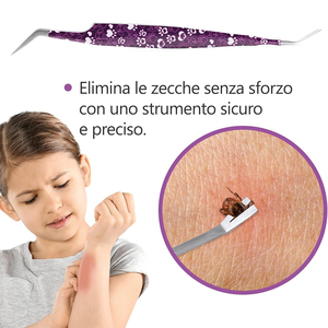 Removedores de Garrapatas 2 en 1 para Perros y Gatos con Acabado de Arena Personalizado, Herramientas de Acero Inoxidable con Punta Puntiaguda de 14.4 cm para Eliminar Garrapatas de Animales - Product Image 3