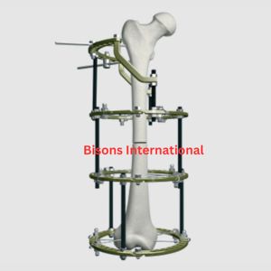 Sistema de Anillo y Marco de Fijación Externa Ilizarov de Acero Inoxidable BISONS para Cirugía de Trauma y Ortopedia - Product Image 1