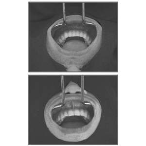 Retractor Labial y de Mejillas de Alta Calidad para Odontología, Instrumento Quirúrgico - Product Image 4