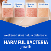 K Beauty 100% Microbiome Centella sérum avec AHA PHA LHA BHA Glow raffinage de la peau soins de la peau coréens OEM ODM