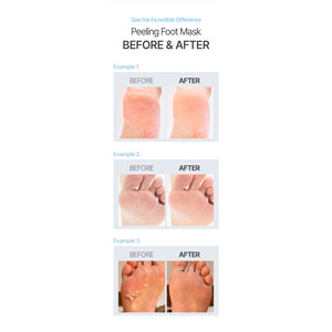 Masque pour les pieds de luxe SALM MOA, pack non tissé, exfoliant, absorption rapide, essence infusée, réparation des talons secs, OEM ODM, soin de la peau exfoliante - Product Image 6