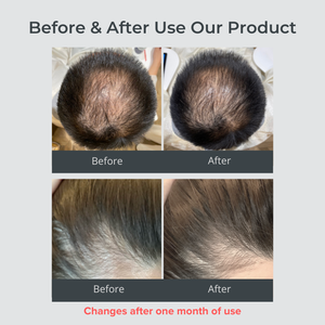 Wholesale Lightweight Non Sticky Texture Easy To Use <b>Spray</b> Hair Scalp Care Serum - Product Image 5