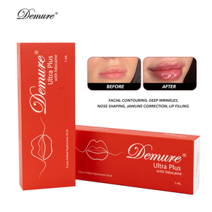 <span class=keywords><strong>Acide</strong></span> <span class=keywords><strong>hyaluronique</strong></span> réticulé, gel injectable 1 ml pour le remodelage des lèvres, du nez, du <span class=keywords><strong>menton</strong></span> et la correction des plis nasogéniens - Product Image 4
