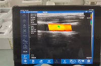 Profesional New Pocket Palm 80 Elements Wireless USG Convex/Linear Phased Probe untuk Iphone dan Ipad