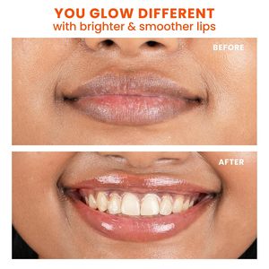 Baume à lèvres éclaircissant Foxtale SPF 30 pour lèvres foncées avec peptides et vitamine C |   Éclaircit |   Hydrate |   12g - Product Image 6