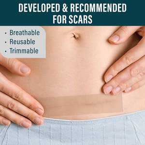Parche médico para cicatrices de sección C Hojas de cubierta de silicona para cicatrices <span class=keywords><strong>antes</strong></span> <span class=keywords><strong>y</strong></span> después - Product Image 6