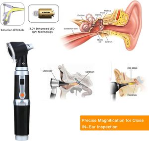 ชุดอุปกรณ์ตรวจหูแบบมืออาชีพ พร้อมหลอดไฟ LED 3.0V, กำลังขยาย 3 เท่า, หัวส่อง 4 ขนาด - สำหรับเด็ก, ผู้ใหญ่ - Product Image 3