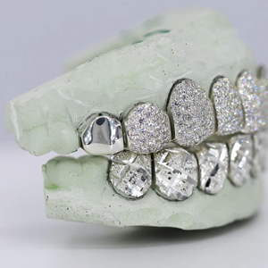 Grillz dentaire Hip Hop personnalisé en argent 925, serti de diamants Moissanite, bijoux dentaires en argent, meilleur prix - Product Image 3