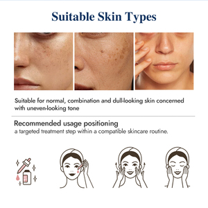 Suero Facial Concentrado de Nicotinamida para Iluminar la Piel, Hidratar, Equilibrar la Oleosidad y Reducir Manchas Oscuras - Product Image 4