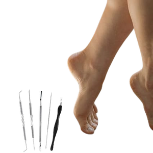 Lime à ongles incarnés en acier inoxydable de qualité supérieure, outil professionnel de pédicure, traitement des ongles incarnés, kit de pédicure - Product Image 3