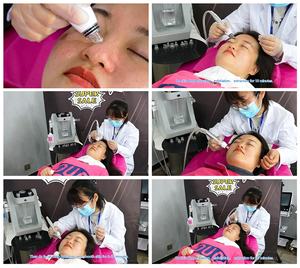 Taibo, terapia de cuidados com a pele, peeling facial - Product Image 6