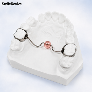 <span class=keywords><strong>Appareil</strong></span> orthodontique personnalisé <span class=keywords><strong>pour</strong></span> la correction des habitudes de succion, <span class=keywords><strong>pour</strong></span> l'arcade supérieure avec bandes molaires, appareils dentaires en gros <span class=keywords><strong>pour</strong></span> les cliniques - Product Image 2