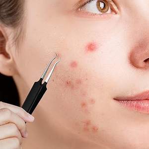 Pince à points noirs pour l'élimination des comédons, pince courbée pour points noirs, pince fine pour extensions de cils - Product Image 6