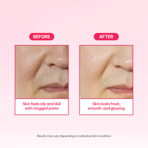 Millford AC Bubbly Wash-Off Pack, Orgánico, Vegano, para Piel Seca y Sensible, 125 ml, Hecho en Corea, Certificado CPNP, Cosméticos Coreanos - Product Image 5