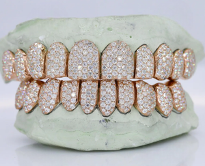 Grillz en argent sterling 925 sertis de moissanite, ajustement personnalisé, bijoux dentaires pour hommes et femmes, accessoire de mode - Product Image 3