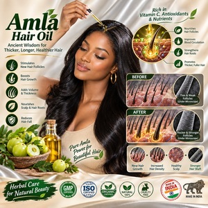 Huile de croissance capillaire naturelle – Romarin, Amla & Huile de ricin – Huile de soin du cuir chevelu et des cheveux à base de plantes – Vente en gros sous marque privée - Product Image 6