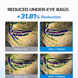 [LABCODE] Crème Contour des Yeux Anti-Rides Intensive PDRN 30ml Raffermissante Hydratante Éclaircissante Anti-Poches Cernes Soin des Yeux Pour Tous - Product Image 4