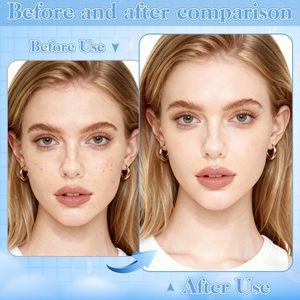blackhead removal tool kit acne removal tool kit comedone <b>extractor</b> set blackhead <b>extractor</b> kit facial pore <b>cleaner</b> set blackhea - Product Image 4