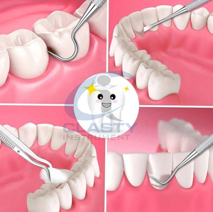 Détartreur dentaire endoscopique : Sonde médicale pour le nettoyage des taches et du tartre – Outils de soins bucco-dentaires - Product Image 4