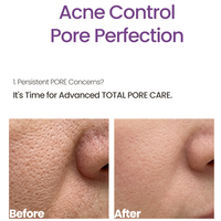Kore cilt bakımı PDRN Traneksamik Asit Serumu Altın Peptit koyu leke hiperpigmentasyon AHA Günlük Peeling Derin Nemlendirme