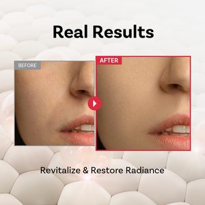 [APOTHE] Ampoule Multi-Récupération au Peptide 11 Botulinum 30ml Flacon Liquide Anti-Âge Anti-Rides Raffermissant Élasticité Éclat Tout-en-un - Product Image 2