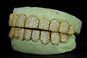 Venta al por mayor de Grillz dentales de plata 925 personalizados con diamantes VVS cultivados en laboratorio, con incrustaciones de diamantes, escaneo dental 3D, proceso rápido y que pasan la prueba del probador de diamantes - Product Image 5