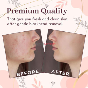 เครื่องกำจัดสิวหัวดำแบบมืออาชีพรักษาจุดสิวหัวสิวหัวขาวสิวสองด้านนุ่ม - Product Image 6